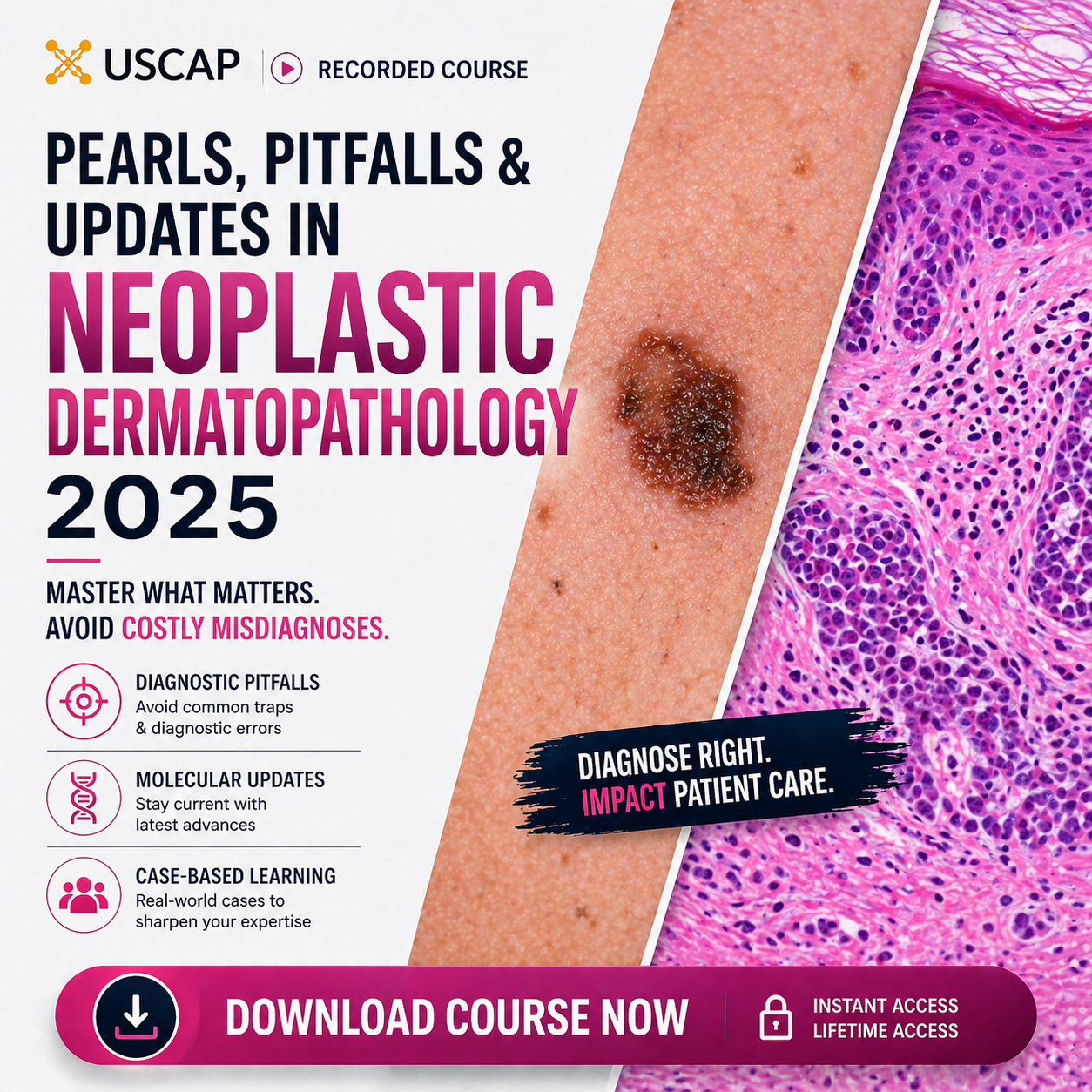 ChatGPT-Image-29-avr.-2026-22_02_11.png USCAP Pearls, Pitfalls, and Updates in Neoplastic Dermatopathology 2025 - Image 1