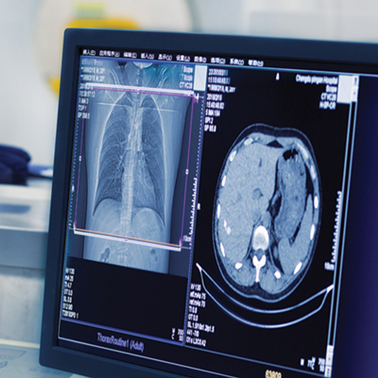 University-of-Washington-Emergency-Radiology-Review.jpg University of Washington Emergency Radiology Review 2023 - Image 1